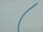 MISSING THUMBNAIL